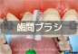 歯間ブラシ