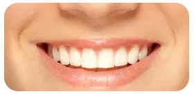 クリーニングの写真